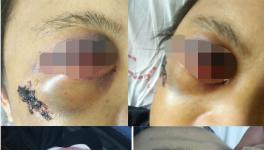 快訊 | 華潤(rùn)水泥分廠發(fā)生事故?。ǜ綀D）